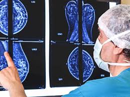 Image result for Mammogram Interpretation