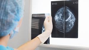 The kaggle breast histopathology images dataset was curated by janowczyk and madabhushi and roa et al. Ai Outperforms Doctors Diagnosing Breast Cancer Bbc News