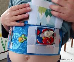 Mic Key Button Peg Feeding Tube Belt Made From Peppa Pig Fabric In 2020 Feeding Tube Pig Fabric Gtube
