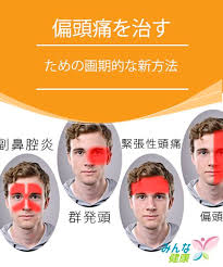偏頭痛を治すための画期的な新方法 みんな健康 治す 健康 偏頭痛