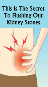 This Is The Secret To Flushing Out Kidney Stones Howsite Kidney Cleanse Kidney Stones Kidney Health