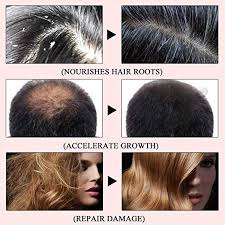 One of the side effects of having more dht than you need is prostate growth which leads eventually to prostate cancer once the prostate gets large enough. Natural Dht Blocker Prevent Hair Loss Vitamins Growth Promoter Free Ship Hair Scalp Treatments Aliexpress