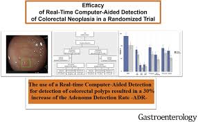 Maybe you would like to learn more about one of these? Efficacy Of Real Time Computer Aided Detection Of Colorectal Neoplasia In A Randomized Trial Gastroenterology