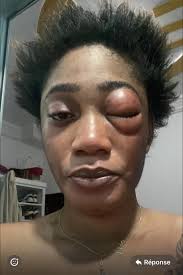 Piffo donne sa version concernant l'histoire avec Cyndi B