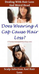 Hair Loss Can High Lead Content Cause Hair Loss Hair Loss Hair Loss Natural Treatmeants That Work Hair Loss Lenalid Natural Hair Loss Hair Loss Women Hair Loss