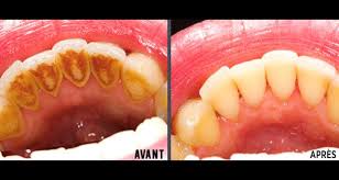 Epingle Sur Sante Naturelle