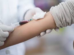 Ea nu este insa specifica, adica nu poate indica natura sau localizarea respectivului proces inflamator. Proteina C Reactiva Testul De Sange Crp SÄƒnÄƒtate Non Stop