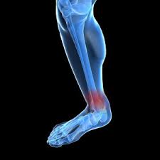 Ayak Bilegi Rahatsizliklari Profosor Doktor Senol Akman Ortopedi Ve Travmatoloji Uzmani