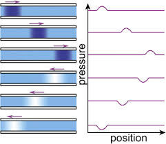 Image result for Pulse Pressure