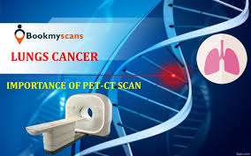 Ppt What Is Pet Ct Scan Get A Detailed Overview Checkout The Real Cost Of Pet Ct Scan Powerpoint Presentation Id 7952347