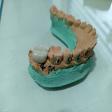 ceramic Crown product image