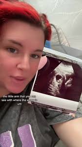 Storytime Videos Anna Jason and Chloe Ultrasound