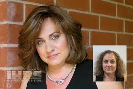 Women S Non Surgical Hair Replacement Results Ihrs Jacksonville Fl
