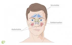 Nasennebenhohlenentzundung Sinusitis Symptome Hausmittel Medikamente Dauer Onmeda De