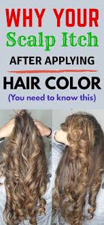 Itchy Scalp After Hair Color Here S Everything You Need To Know In 2020 Scalp Itch Hair Hair Color