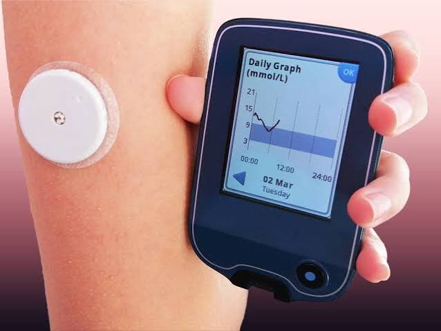 cgm machine in chandigarh