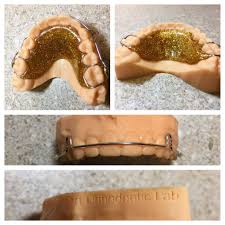 It is also recommended to brush your teeth after meals to keep your retainer clean. Artorhto Orthodontic Orthodonticlab Retainer Art Orthoart 3d 3dprinter 3dscan Digitalortho Scan Printed Braces Colors Teeth Braces Braces Tips