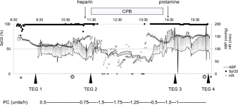Image result for Platelet Function Closure Time