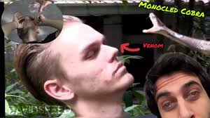 “COBRA SPITS VENOM IN MY EYES!!”