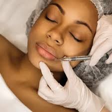 Dermal Fillers for Las Vegas and Henderson, NV and Lake Havasu City,  Kingman and Bullhead City, AZ