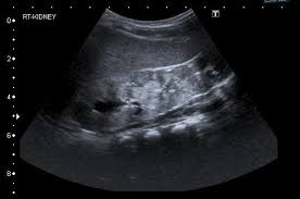 Image result for Ultrasound