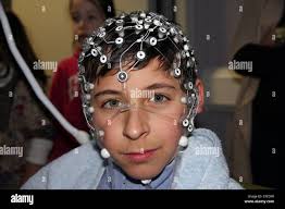 Cerveau en développement Banque de photographies et d'images à haute  résolution