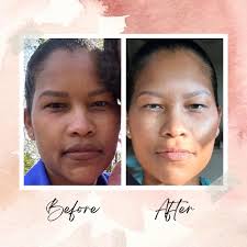 Anew Beauty Clinic (@ExperienceAnewBeautyClinic) • Facebook