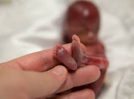 Las Impresionantes Fotos Del Bebe De Solo Cuatro Meses De Gestacion El Diario 24