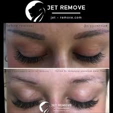Depending on the location and size of your tat, applying makeup to a tattoo everyday can be a nuisance. Tattoo Remover Jet Remove Permanent Makeup And Tattoo Removal