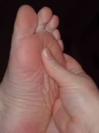 Healing Heel Pain With Reflexology Hand To Health