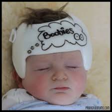 Putting the 'Play' in Plagiocephaly (pla•gi•o•ceph•a•ly)