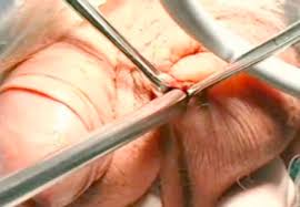 Stomach, liver, intestine, bladder, lung, testicle, spine, pancreas, kidney, heart, bladder icon. Scrotum An Overview Sciencedirect Topics