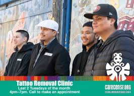 Javaheri has a leading technology to remove or augment unwanted tattoos called the quanta q plus c tattoo removal system. Sfilen Carecen Sf S Tattoo Removal Clinic