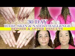 No matter how i wore my hair (ponytail or down), the massive spots of baldness were visible. It Works Hair Skin Nails Before And After Pictures Jobs Ecityworks