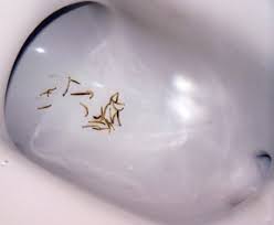 Perfumery, cosmetic or toilet preparations commodity code: Moth Fly Larvae Cause A Stir In Bathroom Toilet Msu Extension