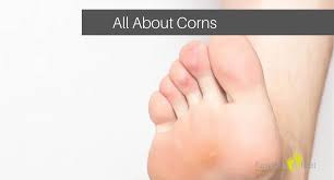 Image result for Corns