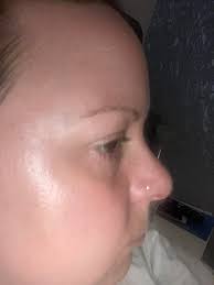 This is my review and I forgot to take side view before pick 🙈 however u  can see 1 before and 2 after