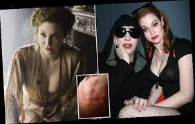 Does it change the fact that this story keeps coming up with his exes. Game Of Thrones Actress Esme Bianco Accuses Marilyn Manson Of Abuse The Projects World