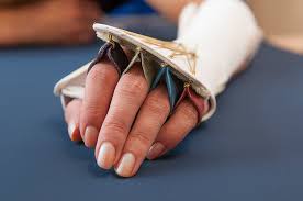 Schienenversorgung Ergotherapie Und Handtherapie Koln