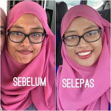 Meh.. meh sini semua!! Ada perkara penting kak bell nk tunjuk dengak  uolls.. Seribella boleh buat silap mata buat korang cantik jelita!! Jom  selak2 feedback cust kak bell yang dah consume Seribella..