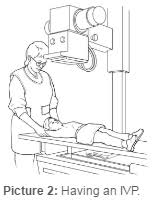 Image result for Intravenous Pyelogram