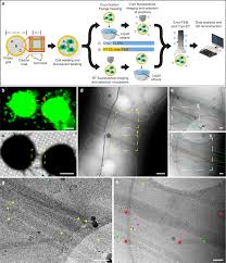 Check spelling or type a new query. Correlative Cryo Electron Microscopy Reveals The Structure Of Tnts In Neuronal Cells Nature Communications