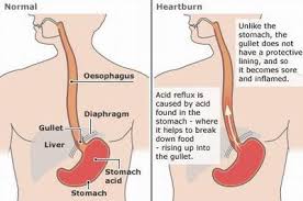 Maybe you would like to learn more about one of these? Mengapa Pedih Ulu Hati Ketika Berpuasa Dan Tips Mudah Untuk Mengatasinya Genkimomma My