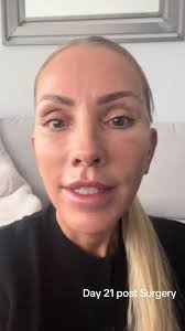 Michelle Burrows Sample