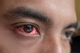 Maybe you would like to learn more about one of these? Is Your Pink Eye A Symptom Of Covid 19 Atlantic Eye Institute