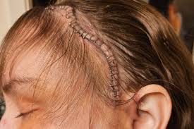 Fundraiser by Rick and Amy Cook : Help Amy Keep Her Home During Brain Tumor  Battle