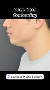 Andre Levesque M.D. (@doctorlevesque) • Instagram photos and videos