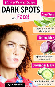 Best Homeremediesfordarkspots On Face Dark Spots On Face Skin Care Remedies Face Scrub Homemade