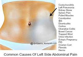 Pin On Abdominal Pain And Stomach Pain