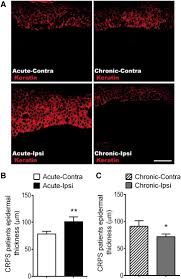 The syndrome of hemophagocyticlymphohistiocytosis in primary immunodeficiencies. Activation Of Cutaneous Immune Responses In Complex Regional Pain Syndrome The Journal Of Pain